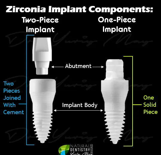 Zirconia Implants FAQ Everything YOu need to Know Dr. May Best Zirconia implant dentist