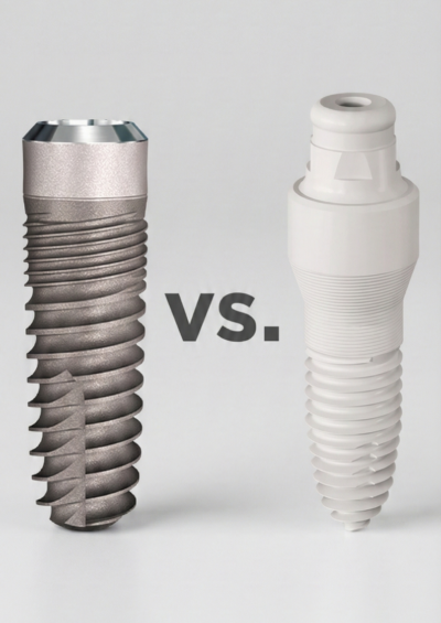 Titanium vs Zirconia Image Generic
