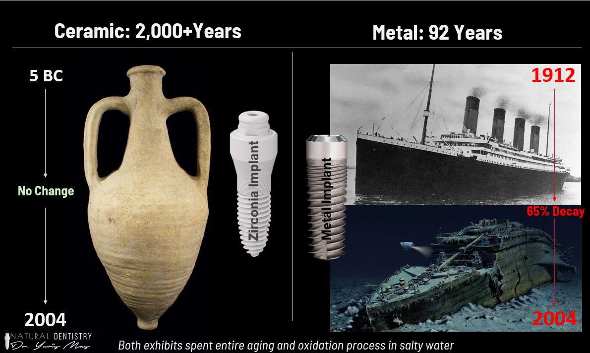 Ceramic implants do not corrode or oxidize like Metal Titanium Implants - Example of Titanic Rusting vs Ceramic Unaged