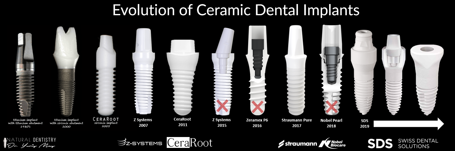 Zirconia Dental Implant Types and Brands - Historical Evolution - Zirconia Dental Implant Dentist Dr. May
