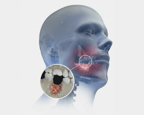 jaw