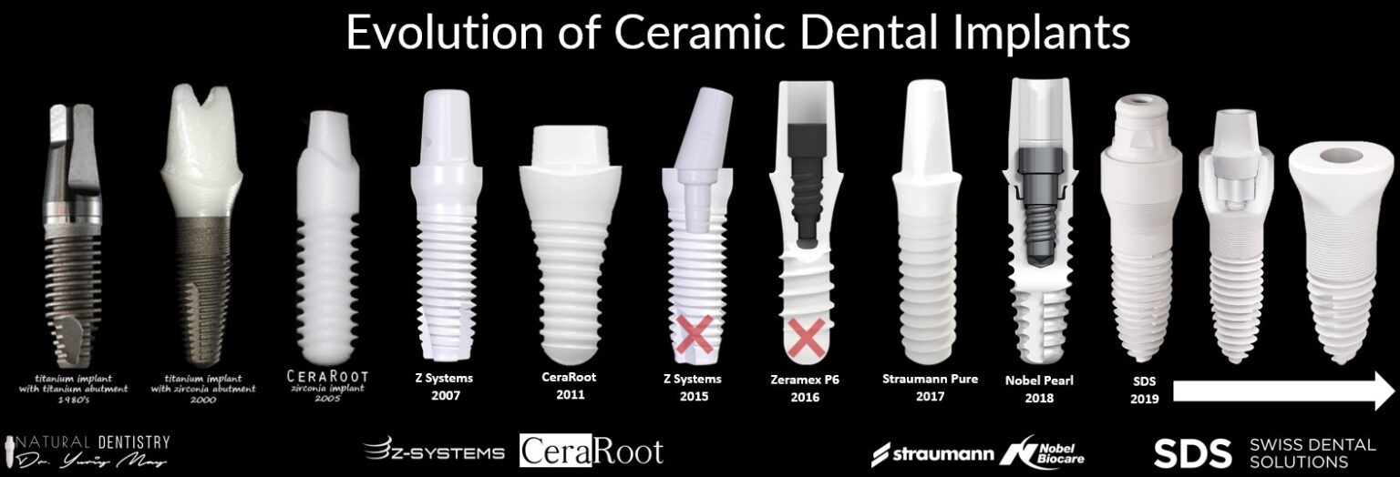 Zirconia Dental Implant Types and Brands - Historical Evolution -Zirconia Dental Implant Dentist Dr. May